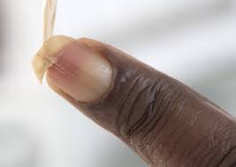 zwarte finger zachte nagel